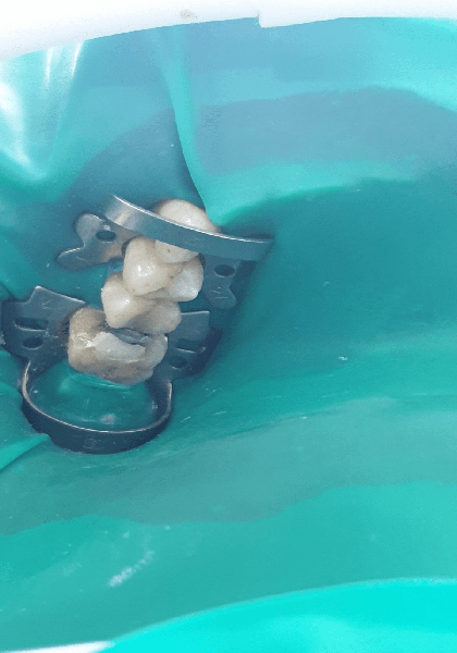 Periodontal Dentistry Treatment in Gandhinagar
